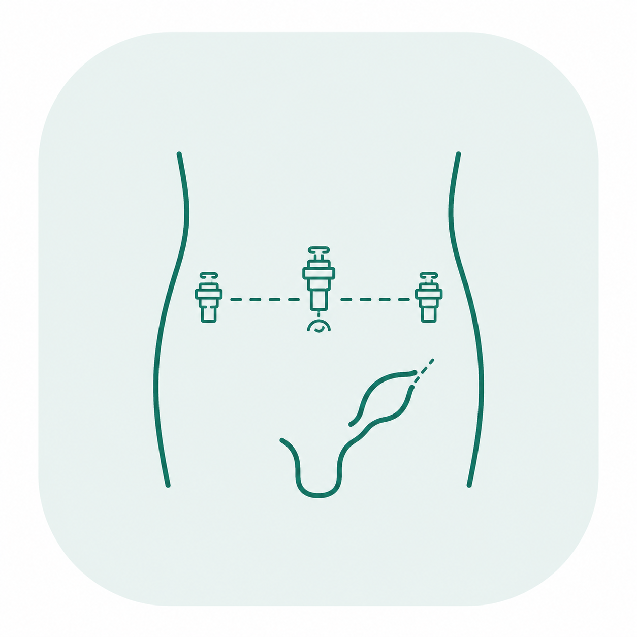 Hernienoperation